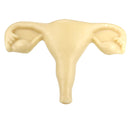Wax uterus